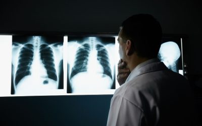 Be Confident in Your Diagnosis with an X Ray Clinic in Mandarin